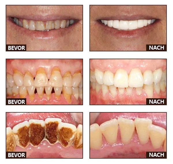 đ„Niacinamid Intensive Whitening Zahnpasta