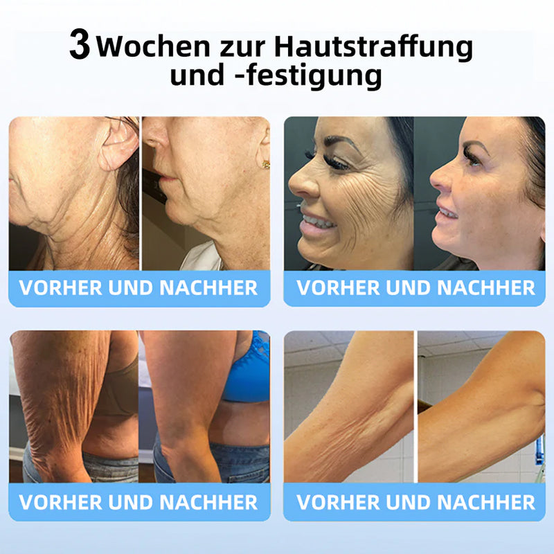 👨⚕️💖ODALIT™ Kollagen-Peptide STRAFFENDES SERUM-STICK