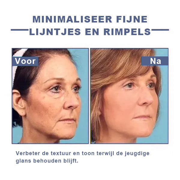 🩵 Last Day Discount: 87% DISCOUNT 🌸𝗝𝗘𝗥𝗘𝗠𝗬𝗧𝗜𝗦™ 𝐀𝐝𝐯𝐚𝐧𝐜𝐞𝐝 𝐅𝐢𝐫𝐦𝐢𝐧𝐠 & 𝐖𝐫𝐢𝐧𝐤𝐥𝐞-𝐑𝐞𝐝𝐮𝐜𝐢𝐧𝐠 𝐂𝐫𝐞𝐚𝐦: 𝗥𝗲𝘀𝘁𝗼𝗿𝗲 𝗦𝗸𝗶𝗻 𝗘𝗹𝗮𝘀𝘁𝗶𝗰𝗶𝘁𝘆⭐