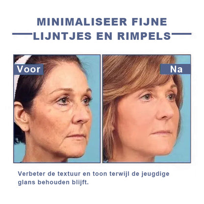 🩵 Last Day Discount: 87% DISCOUNT 🌸𝗝𝗘𝗥𝗘𝗠𝗬𝗧𝗜𝗦™ 𝐀𝐝𝐯𝐚𝐧𝐜𝐞𝐝 𝐅𝐢𝐫𝐦𝐢𝐧𝐠 & 𝐖𝐫𝐢𝐧𝐤𝐥𝐞-𝐑𝐞𝐝𝐮𝐜𝐢𝐧𝐠 𝐂𝐫𝐞𝐚𝐦: 𝗥𝗲𝘀𝘁𝗼𝗿𝗲 𝗦𝗸𝗶𝗻 𝗘𝗹𝗮𝘀𝘁𝗶𝗰𝗶𝘁𝘆⭐