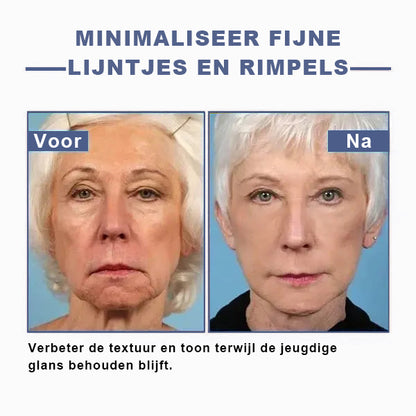 🩵 Last Day Discount: 87% DISCOUNT 🌸𝗝𝗘𝗥𝗘𝗠𝗬𝗧𝗜𝗦™ 𝐀𝐝𝐯𝐚𝐧𝐜𝐞𝐝 𝐅𝐢𝐫𝐦𝐢𝐧𝐠 & 𝐖𝐫𝐢𝐧𝐤𝐥𝐞-𝐑𝐞𝐝𝐮𝐜𝐢𝐧𝐠 𝐂𝐫𝐞𝐚𝐦: 𝗥𝗲𝘀𝘁𝗼𝗿𝗲 𝗦𝗸𝗶𝗻 𝗘𝗹𝗮𝘀𝘁𝗶𝗰𝗶𝘁𝘆⭐