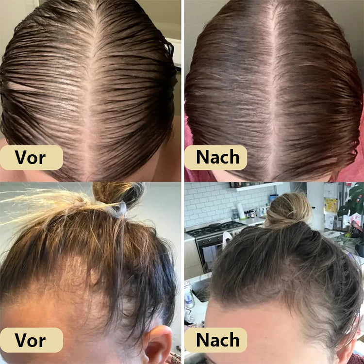 JEREMYTIS Natürliches Haarwachstumsöl