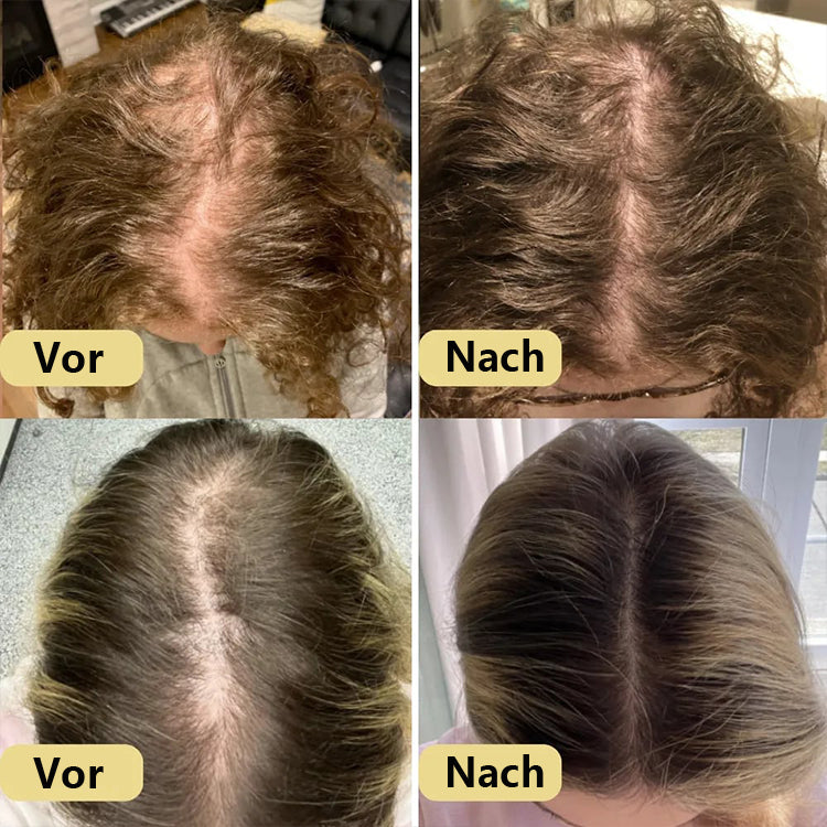 JEREMYTIS Natürliches Haarwachstumsöl