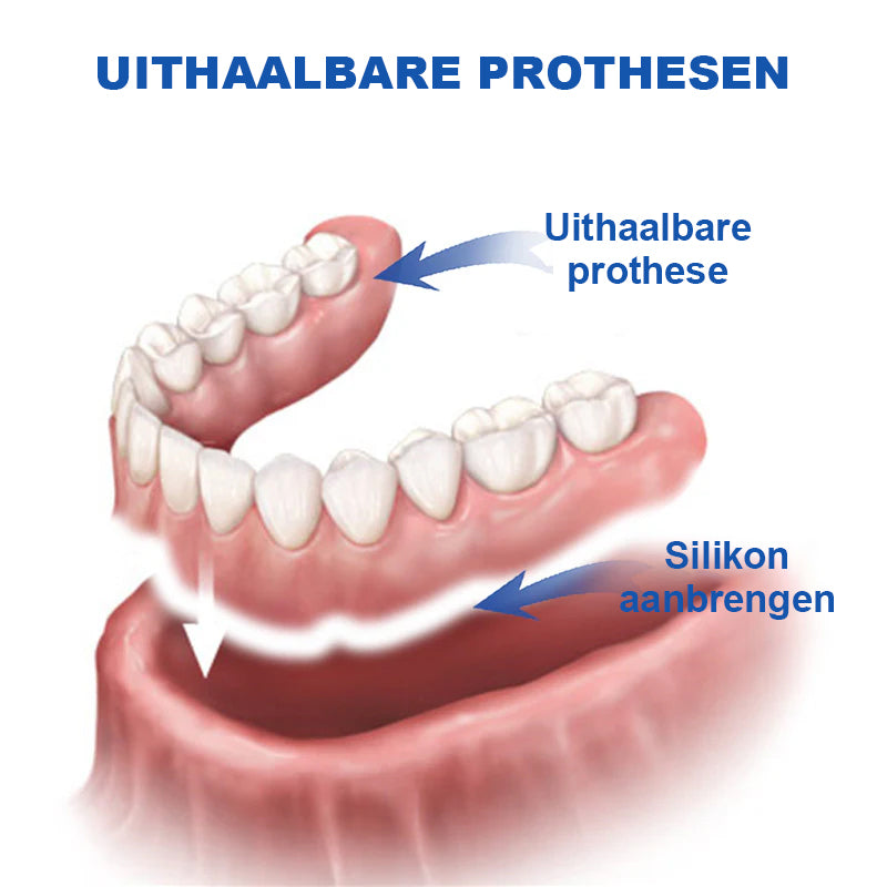 ✨[Officiële Merkwinkel] Seurico™ Thermoplastische Kunstgebitlijm (✨KOOP 2, KRIJG 1 GRATIS 🎁)