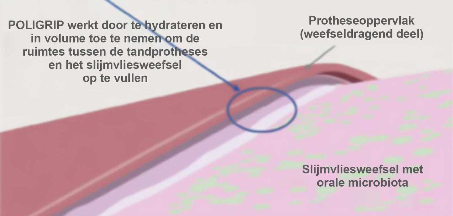 ✨[Officiële Merkwinkel] Seurico™ Thermoplastische Kunstgebitlijm (✨KOOP 2, KRIJG 1 GRATIS 🎁)