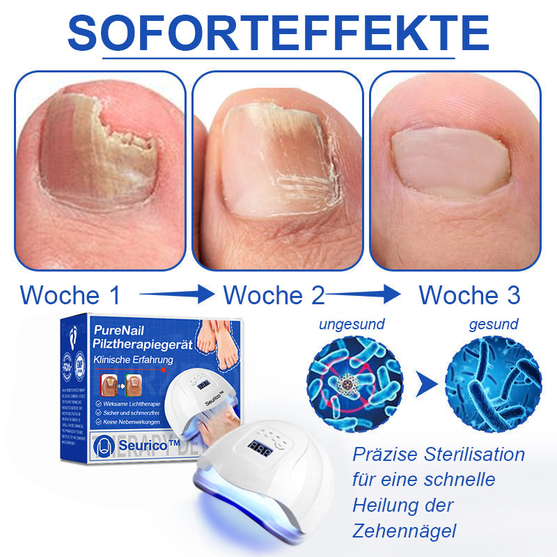 🎅Sonderangebote zu Weihnachten: 62% RABATT🎄Seurico™ PureNail Pilzlasergerät - 🔥Hergestellt und versendet aus Deutschland👏