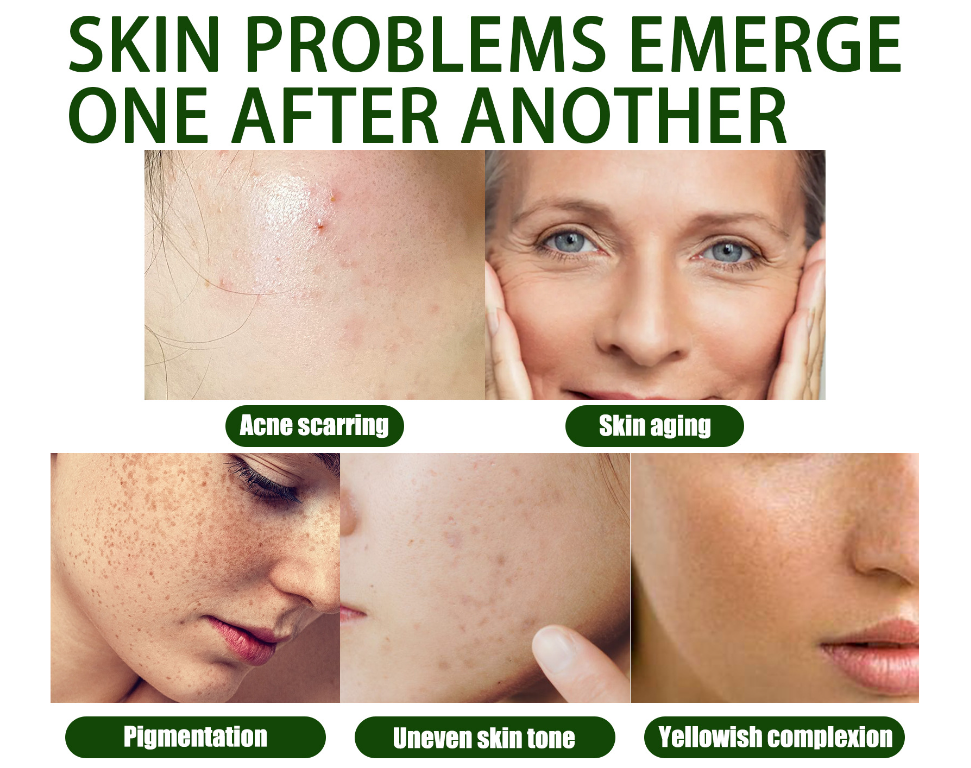 🎄Seurico™ Green Tea Anti-Acne Essence For Anti-aging, anti-wrinkle and Brighten skin colour✨