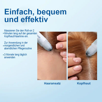 Haarwuchs-Roll-On-Serum – Sichtbarer Haarwuchs in nur 4 Wochen