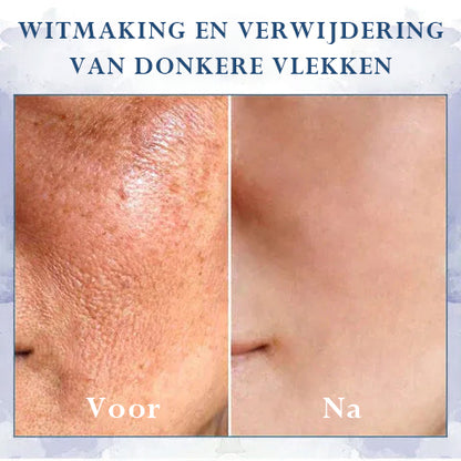 🩵 Last Day Discount: 87% DISCOUNT 🌸𝗝𝗘𝗥𝗘𝗠𝗬𝗧𝗜𝗦™ 𝐀𝐝𝐯𝐚𝐧𝐜𝐞𝐝 𝐅𝐢𝐫𝐦𝐢𝐧𝐠 & 𝐖𝐫𝐢𝐧𝐤𝐥𝐞-𝐑𝐞𝐝𝐮𝐜𝐢𝐧𝐠 𝐂𝐫𝐞𝐚𝐦: 𝗥𝗲𝘀𝘁𝗼𝗿𝗲 𝗦𝗸𝗶𝗻 𝗘𝗹𝗮𝘀𝘁𝗶𝗰𝗶𝘁𝘆⭐