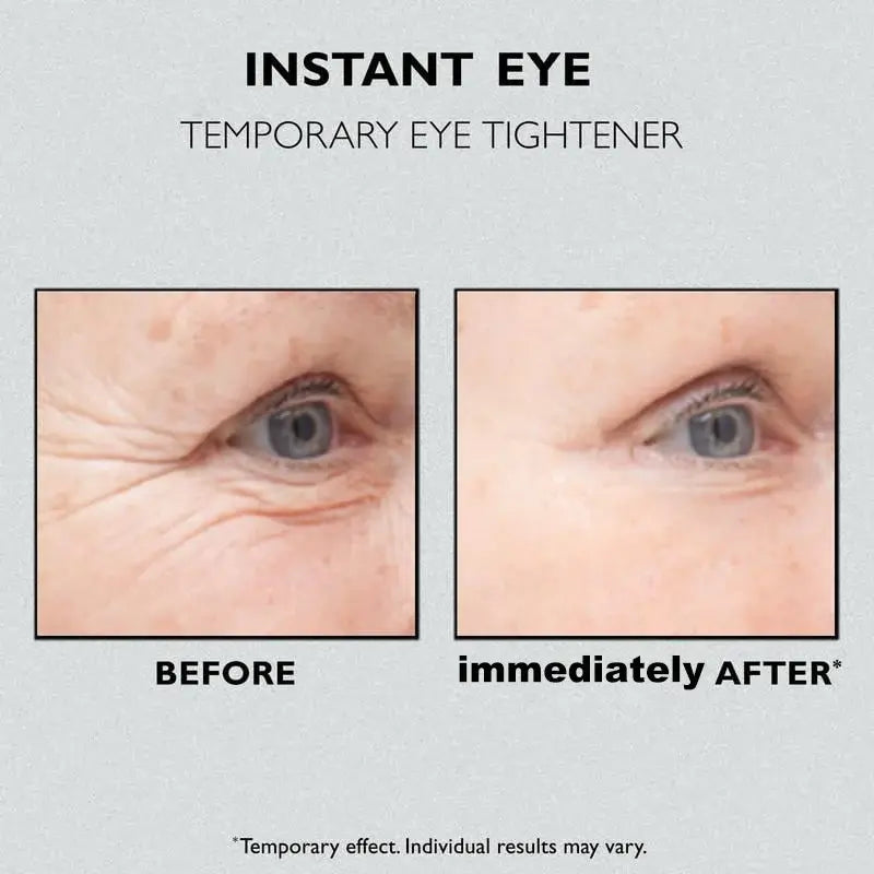 (✨Buy 2 Get 1 Free💕)Instant Eye Temporary Eye Tightener🔥Last Day Sale 50% OFF🔥