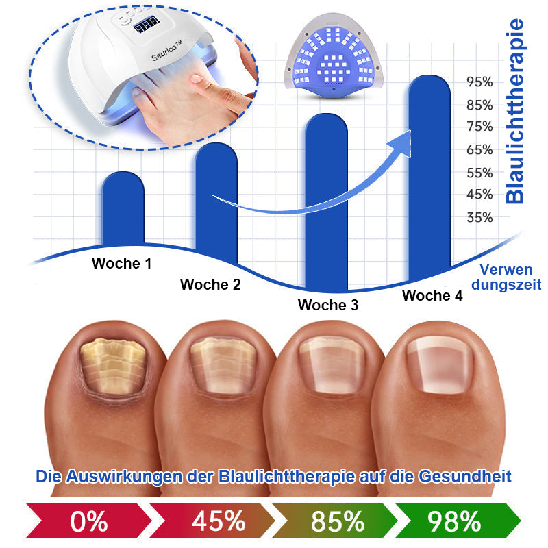 🎅Sonderangebote zu Weihnachten: 62% RABATT🎄Seurico™ PureNail Pilzlasergerät - 🔥Hergestellt und versendet aus Deutschland👏