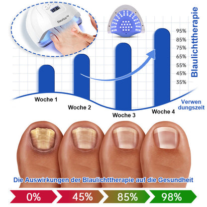 🎅Sonderangebote zu Weihnachten: 62% RABATT🎄Seurico™ PureNail Pilzlasergerät - 🔥Hergestellt und versendet aus Deutschland👏