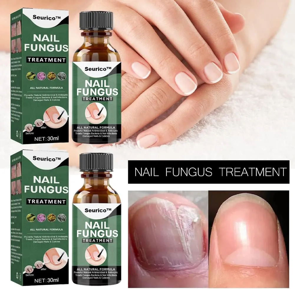 【Officiële Merkwinkel】 BESTE NAGELHERSTEL, STOP SCHIMMELGROEI