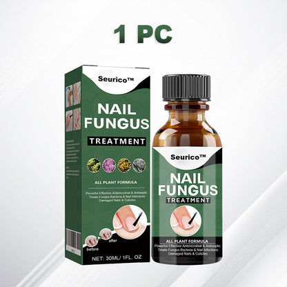 【Officiële Merkwinkel】 BESTE NAGELHERSTEL, STOP SCHIMMELGROEI