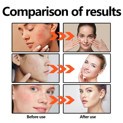 🎄Seurico™ Green Tea Anti-Acne Essence For Anti-aging, anti-wrinkle and Brighten skin colour✨