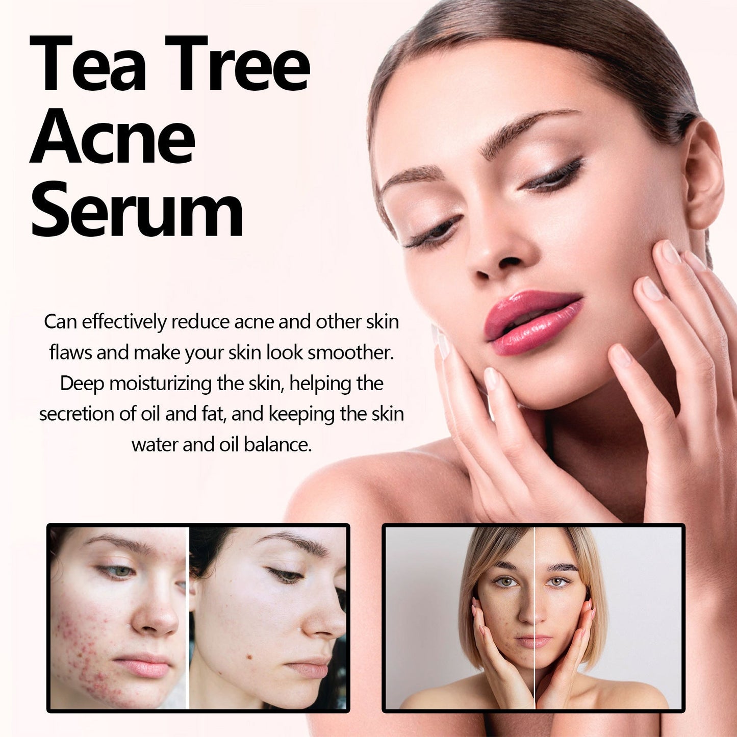 🎄Seurico™ Green Tea Anti-Acne Essence For Anti-aging, anti-wrinkle and Brighten skin colour✨