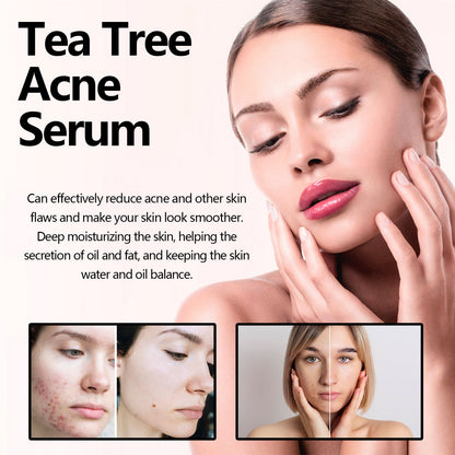 🎄Seurico™ Green Tea Anti-Acne Essence For Anti-aging, anti-wrinkle and Brighten skin colour✨