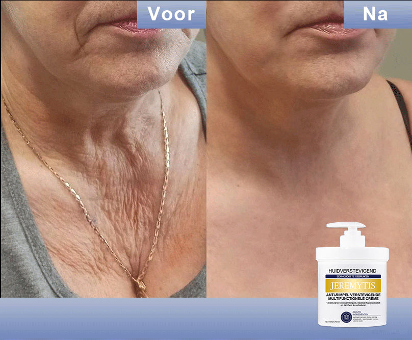 🩵 Last Day Discount: 87% DISCOUNT 🌸𝗝𝗘𝗥𝗘𝗠𝗬𝗧𝗜𝗦™ 𝐀𝐝𝐯𝐚𝐧𝐜𝐞𝐝 𝐅𝐢𝐫𝐦𝐢𝐧𝐠 & 𝐖𝐫𝐢𝐧𝐤𝐥𝐞-𝐑𝐞𝐝𝐮𝐜𝐢𝐧𝐠 𝐂𝐫𝐞𝐚𝐦: 𝗥𝗲𝘀𝘁𝗼𝗿𝗲 𝗦𝗸𝗶𝗻 𝗘𝗹𝗮𝘀𝘁𝗶𝗰𝗶𝘁𝘆⭐