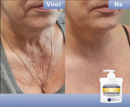 🩵 Last Day Discount: 87% DISCOUNT 🌸𝗝𝗘𝗥𝗘𝗠𝗬𝗧𝗜𝗦™ 𝐀𝐝𝐯𝐚𝐧𝐜𝐞𝐝 𝐅𝐢𝐫𝐦𝐢𝐧𝐠 & 𝐖𝐫𝐢𝐧𝐤𝐥𝐞-𝐑𝐞𝐝𝐮𝐜𝐢𝐧𝐠 𝐂𝐫𝐞𝐚𝐦: 𝗥𝗲𝘀𝘁𝗼𝗿𝗲 𝗦𝗸𝗶𝗻 𝗘𝗹𝗮𝘀𝘁𝗶𝗰𝗶𝘁𝘆⭐