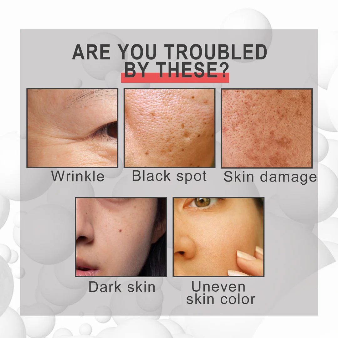 LAST DAY-49%OFF🔥Seurico™ COLLAGEN BOOST ANTI-AGING