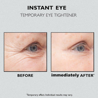 🔥Last Day 49% OFF🔥Lovilds™ Instant Eye Temporary Eye Tightener💕