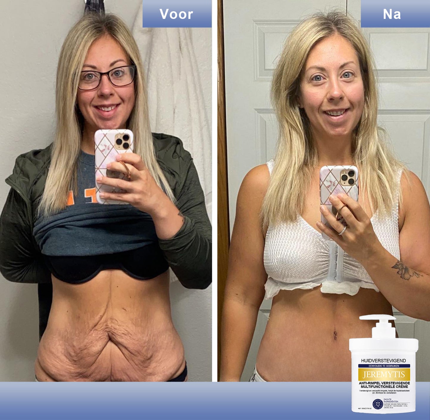 🩵 Last Day Discount: 87% DISCOUNT 🌸𝗝𝗘𝗥𝗘𝗠𝗬𝗧𝗜𝗦™ 𝐀𝐝𝐯𝐚𝐧𝐜𝐞𝐝 𝐅𝐢𝐫𝐦𝐢𝐧𝐠 & 𝐖𝐫𝐢𝐧𝐤𝐥𝐞-𝐑𝐞𝐝𝐮𝐜𝐢𝐧𝐠 𝐂𝐫𝐞𝐚𝐦: 𝗥𝗲𝘀𝘁𝗼𝗿𝗲 𝗦𝗸𝗶𝗻 𝗘𝗹𝗮𝘀𝘁𝗶𝗰𝗶𝘁𝘆⭐