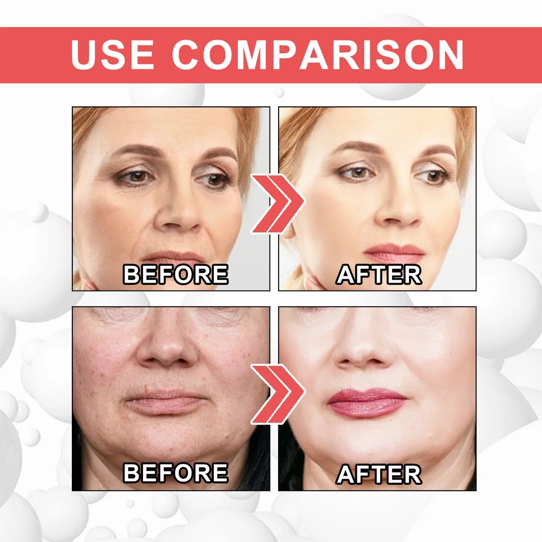LAST DAY-49%OFF🔥Seurico™ COLLAGEN BOOST ANTI-AGING