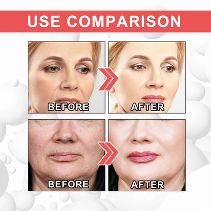 LAST DAY-49%OFF🔥Seurico™ COLLAGEN BOOST ANTI-AGING