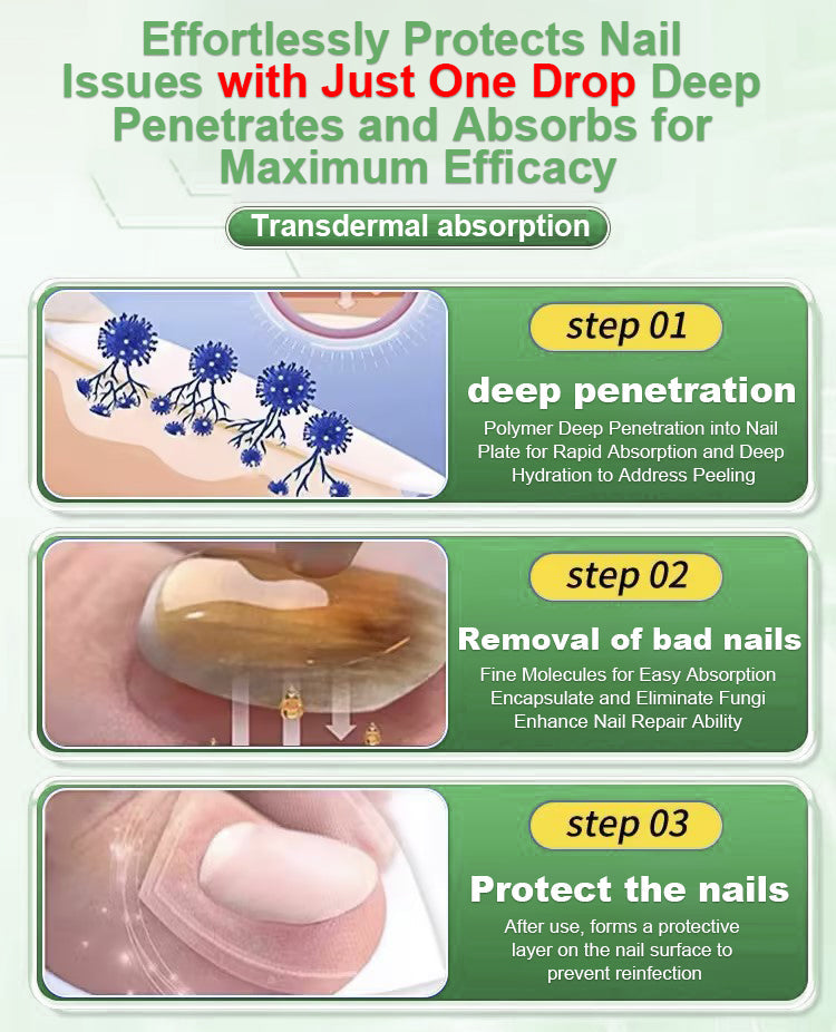 【Officiële Merkwinkel】 BESTE NAGELHERSTEL, STOP SCHIMMELGROEI