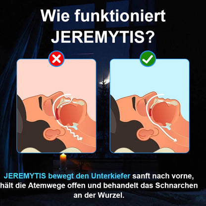 JEREMYTIS™ Verstellbares Anti-Schnarch-Mundstück