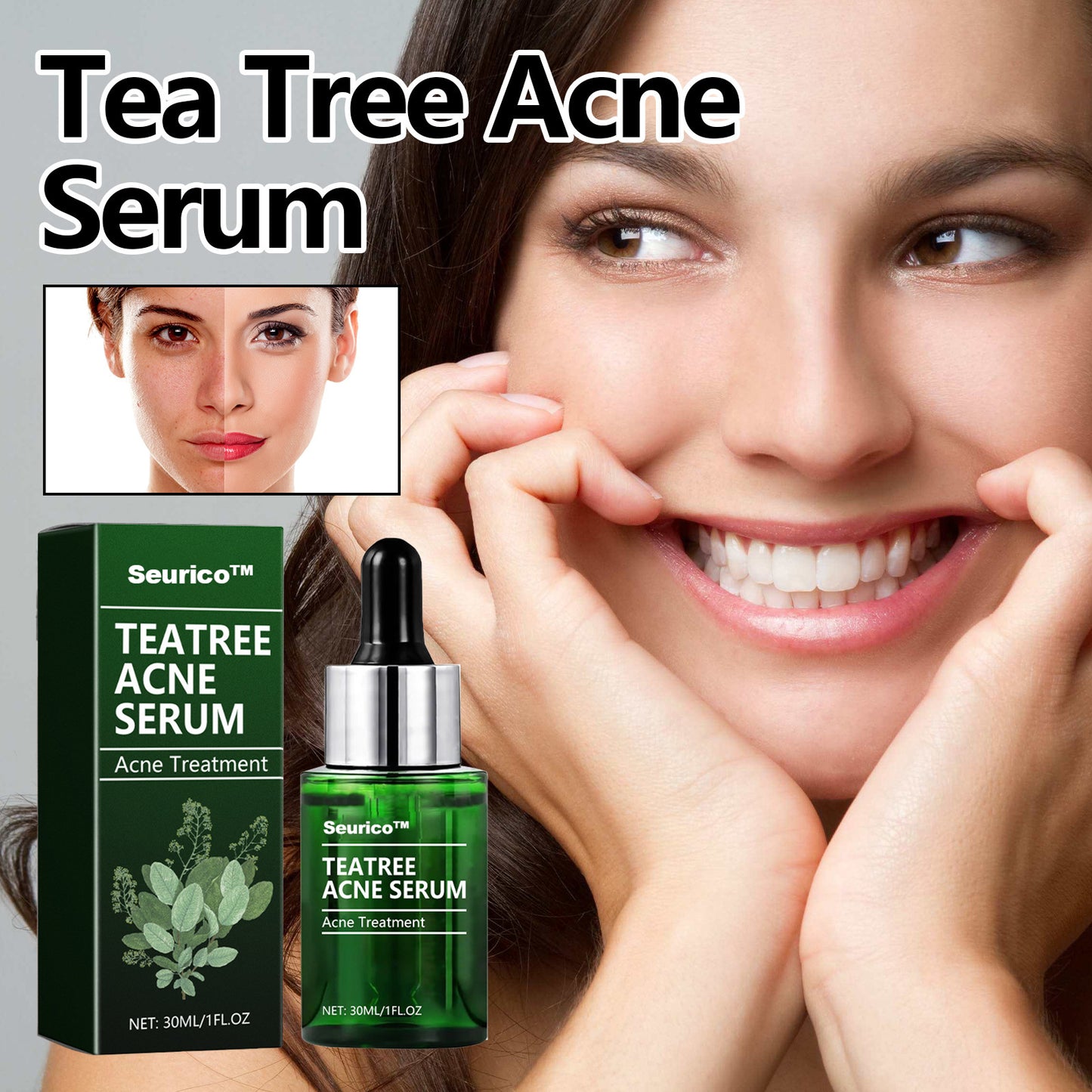 🎄Seurico™ Green Tea Anti-Acne Essence For Anti-aging, anti-wrinkle and Brighten skin colour✨