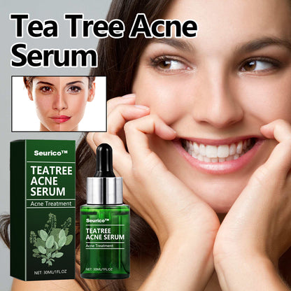 🎄Seurico™ Green Tea Anti-Acne Essence For Anti-aging, anti-wrinkle and Brighten skin colour✨