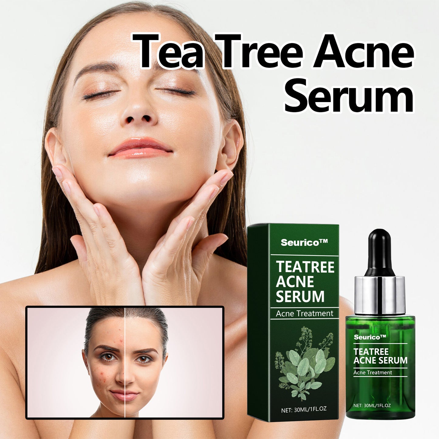 🎄Seurico™ Green Tea Anti-Acne Essence For Anti-aging, anti-wrinkle and Brighten skin colour✨