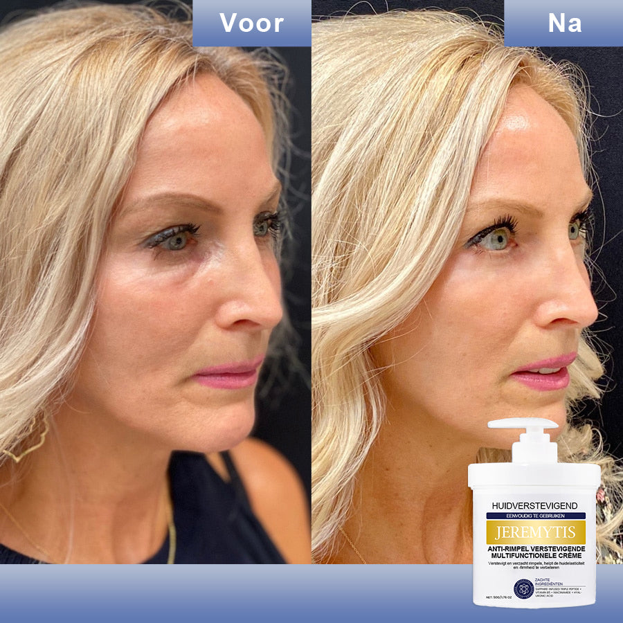 🩵 Last Day Discount: 87% DISCOUNT 🌸𝗝𝗘𝗥𝗘𝗠𝗬𝗧𝗜𝗦™ 𝐀𝐝𝐯𝐚𝐧𝐜𝐞𝐝 𝐅𝐢𝐫𝐦𝐢𝐧𝐠 & 𝐖𝐫𝐢𝐧𝐤𝐥𝐞-𝐑𝐞𝐝𝐮𝐜𝐢𝐧𝐠 𝐂𝐫𝐞𝐚𝐦: 𝗥𝗲𝘀𝘁𝗼𝗿𝗲 𝗦𝗸𝗶𝗻 𝗘𝗹𝗮𝘀𝘁𝗶𝗰𝗶𝘁𝘆⭐