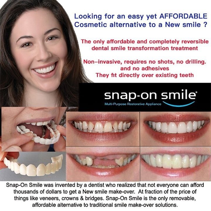 Latest👨‍⚕Adjustable Snap-On Dentures😁 (💥50% OFF) - 🔥HOT SALE🔥🎉