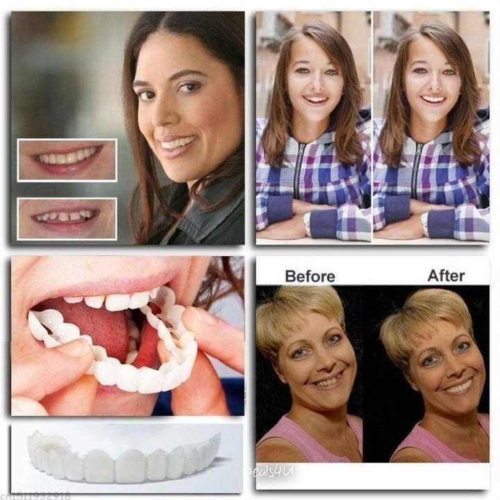 Latest👨‍⚕Adjustable Snap-On Dentures😁 (💥50% OFF) - 🔥HOT SALE🔥🎉